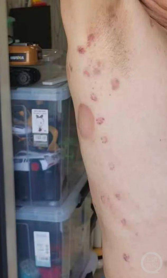 男子称理发店充430万做灌肠后遭退费难，合肥警方深夜通报