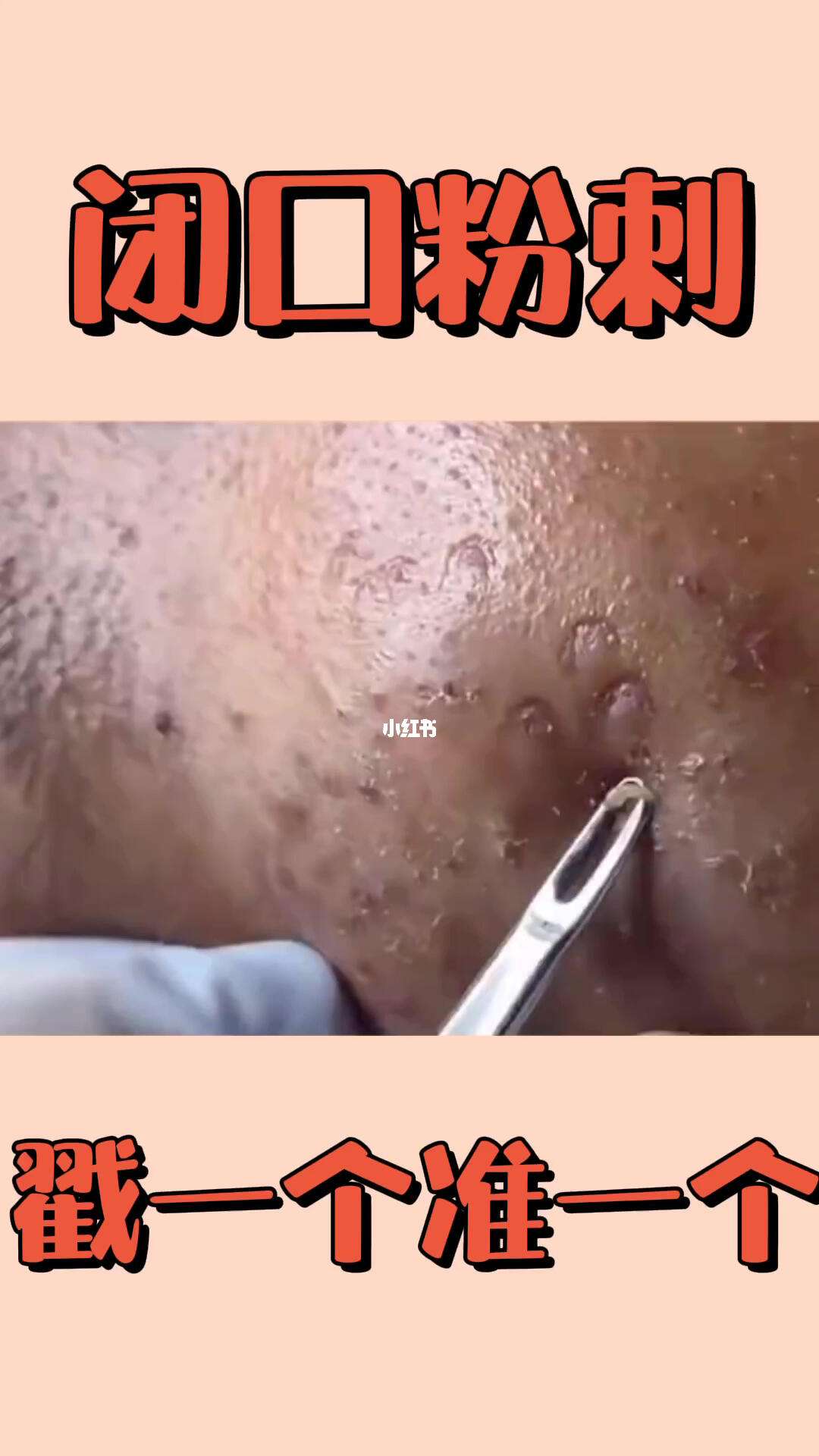 出币口(出币口英文)